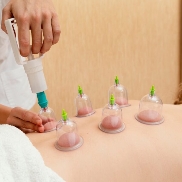 Vacuum Cupping Set ? 6 Pc Muscle Relief Therapy Kit | Arrive Kit
